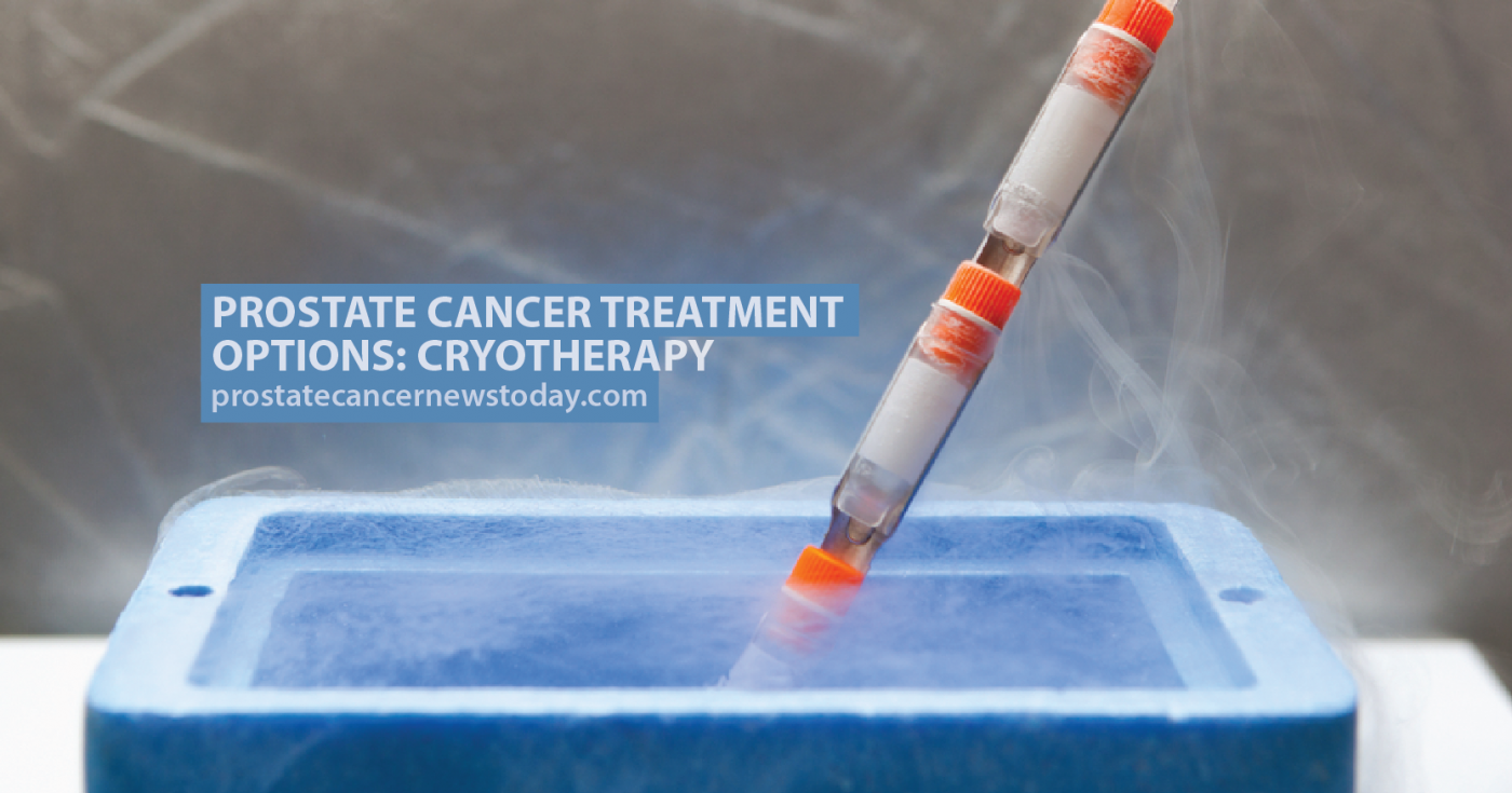 Prostate Cancer Treatment Options Cryotherapy Prostate